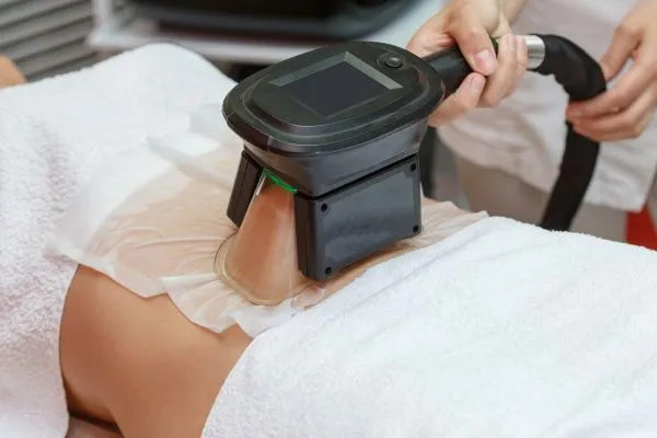 Image of person having fat freezing treatment to help weight gain Coventry