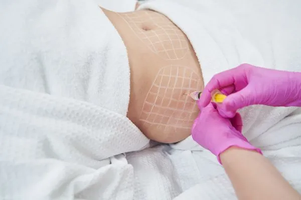image of fat dissolving injections on love handles to help combat weight gain Coventry