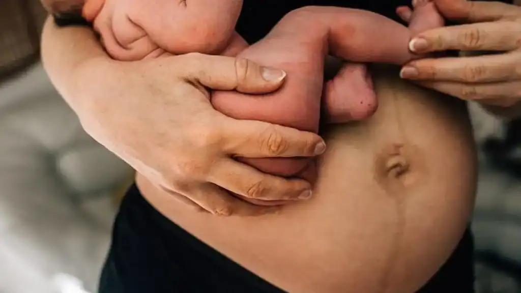 Why Is My Stomach Still Big After Pregnancy Coventry?